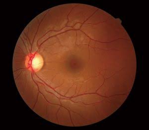 Fundus-Evaluation